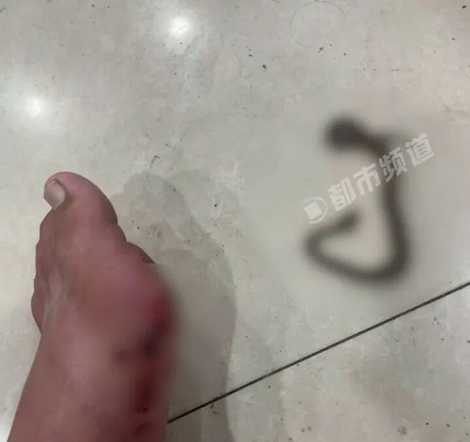 男子路边草丛方便被蛇咬下一秒抓蛇就医！(图1)